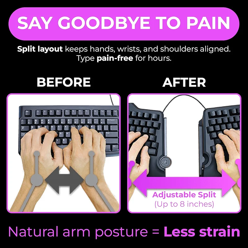 Cloud Nine C989M Ergonomic Mechanical Keyboard for PC - Kailh Tactile — image 3